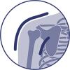 Imobilizácia